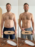 NordBody EMS Cupping Aparat